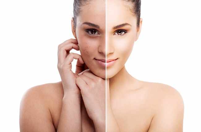 Trucos para rejuvenecer la piel del rostro